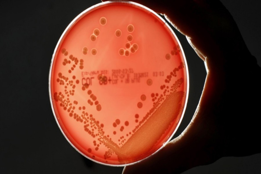 Bactérias Multirresistentes preocupam OMS e a comunidade científica